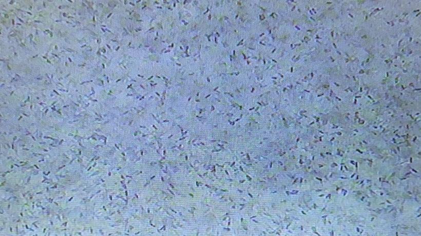 A dog semen sample under the microscope during a sperm count